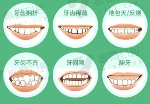 假牙材料全瓷有什么区别,全锆牙冠和全瓷的区别(图1)